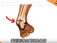开云体育网页版-关于季后赛带伤作战！杰威接受右手韧带撕裂修复手术的信息